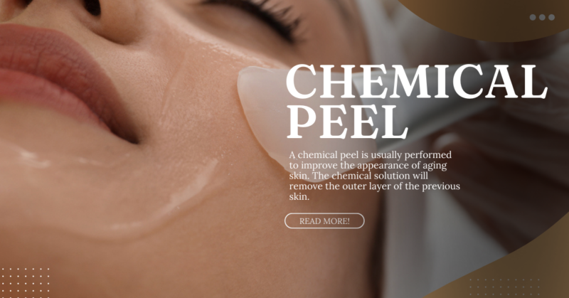 Chemical Peel