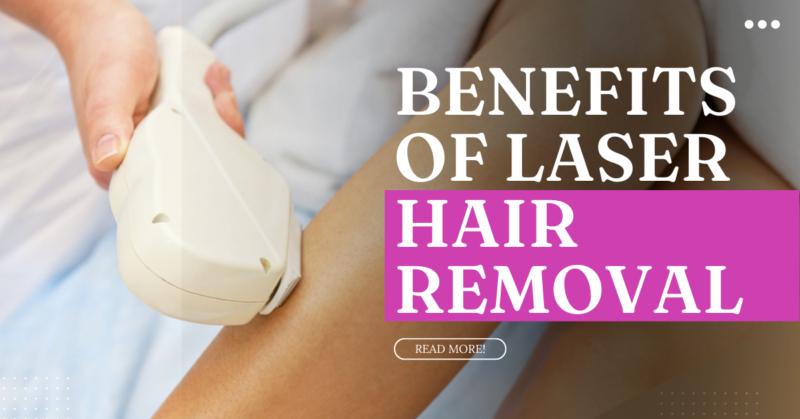 laser hair removal