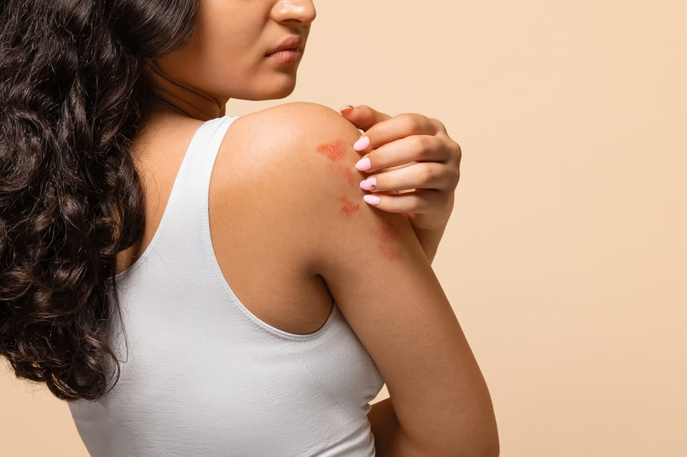 dry skin in winter