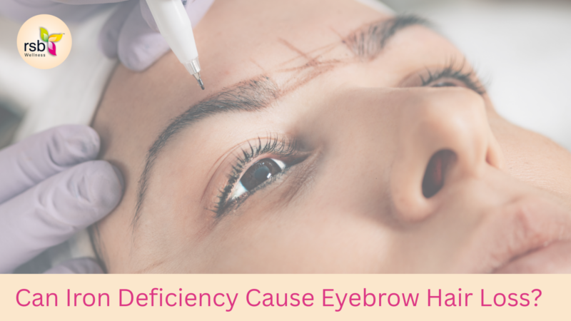 Can Iron Deficiency Cause Eyebrow Hair Loss?