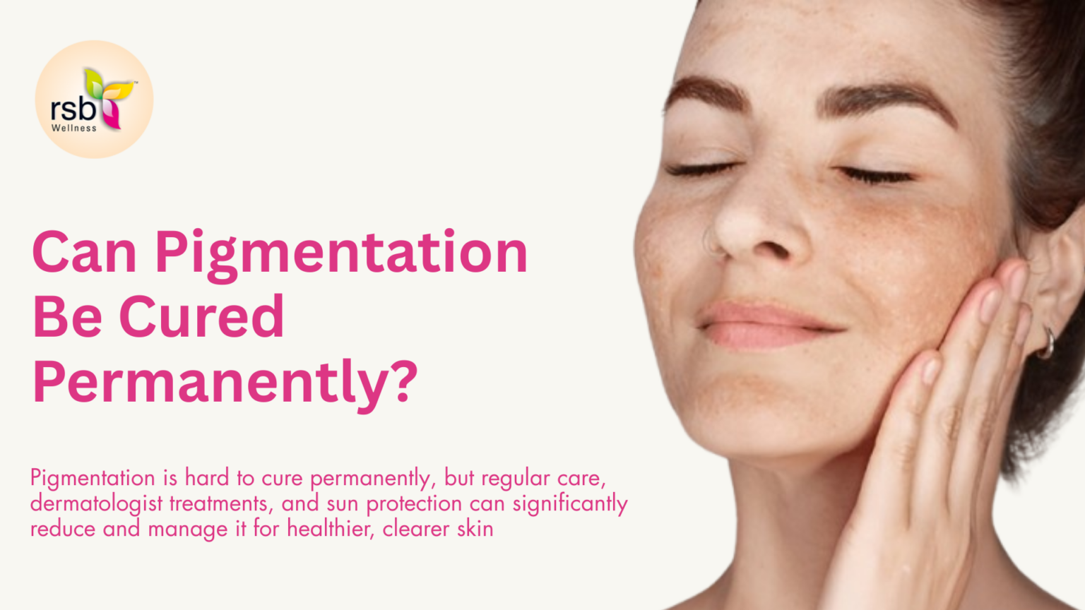 Pigmentation