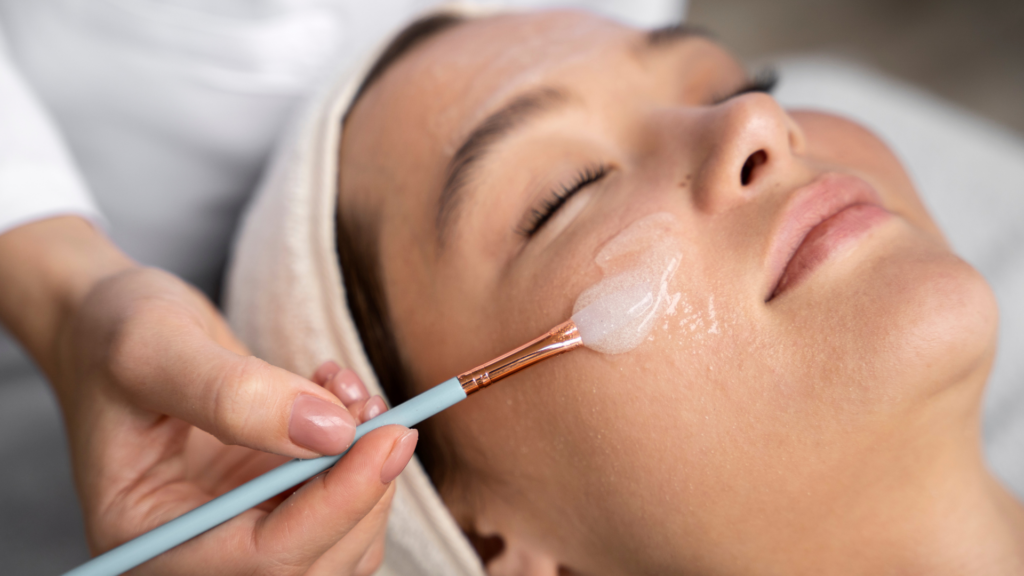Topical Creams and Serums , Chemical Peel Treatment For Hyperpigmentation
