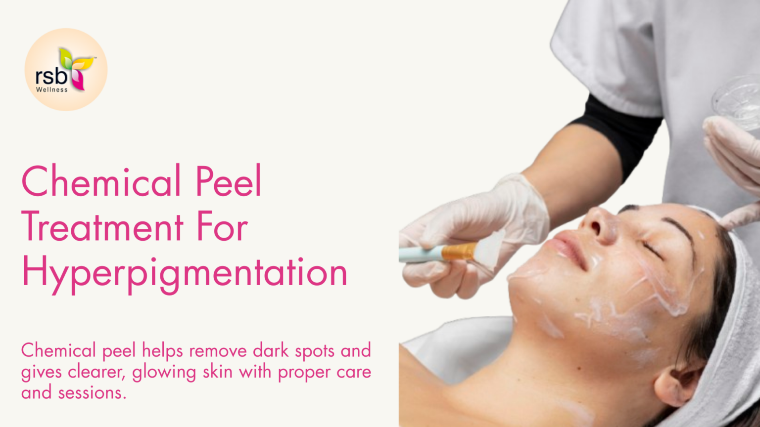 Chemical Peel Treatment For Hyperpigmentation