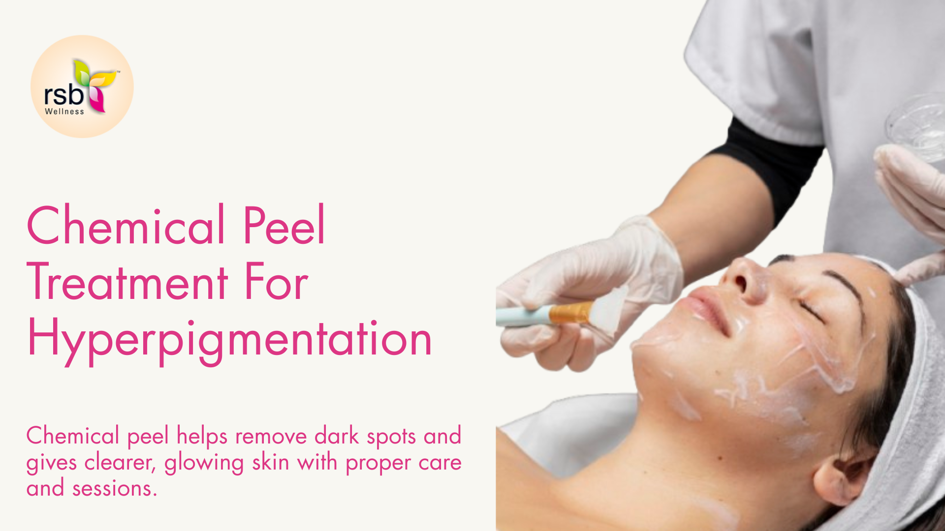 Chemical Peel Treatment For Hyperpigmentation