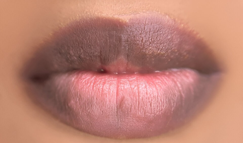 Dark Lips ,How To Lighten Dark Lips