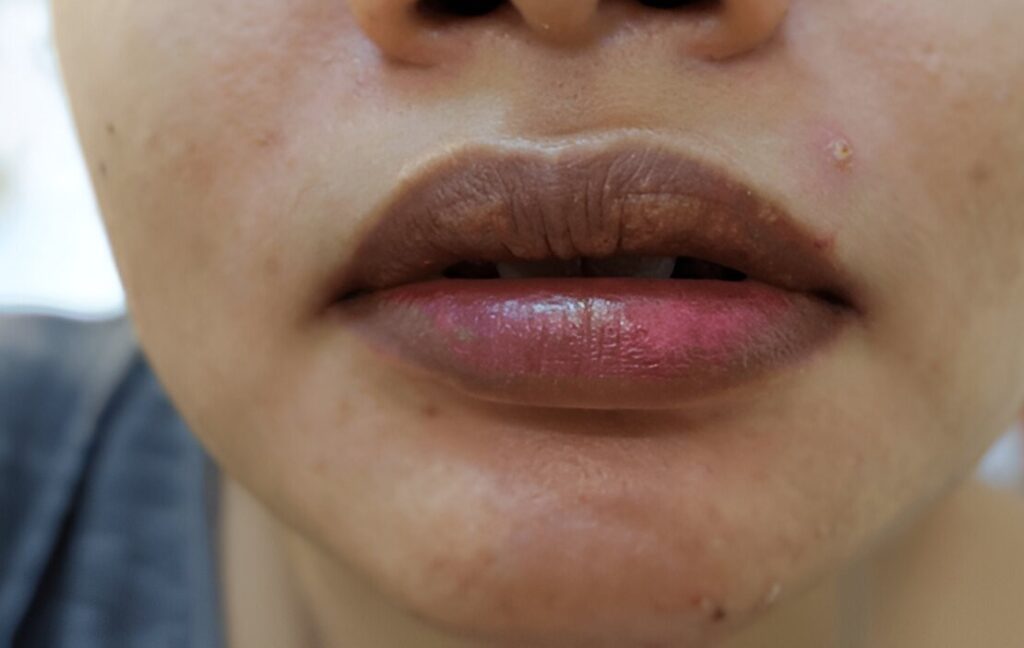 Dark Lips,