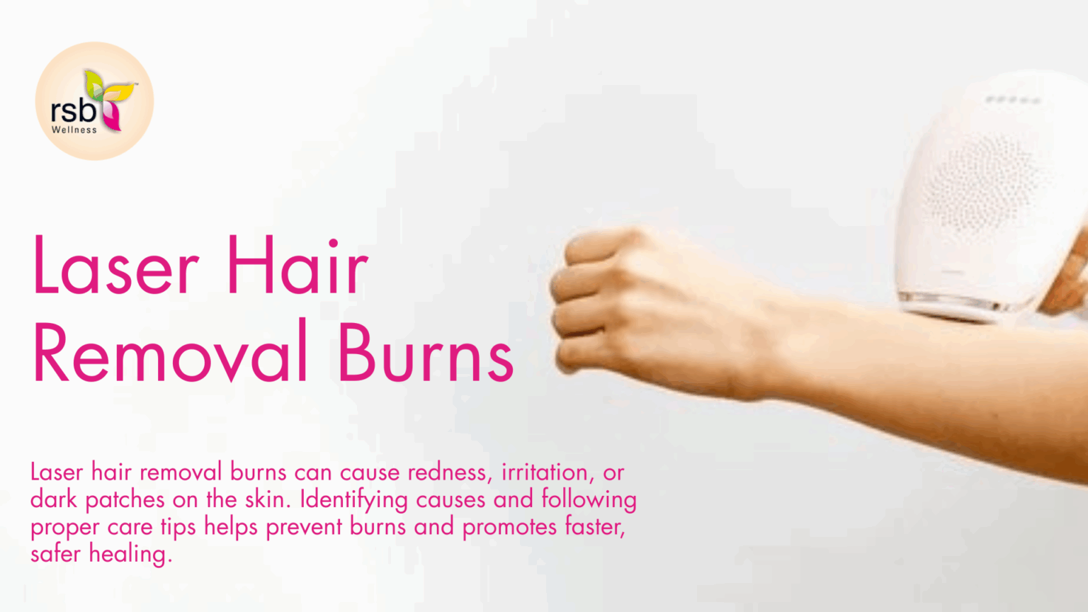 laser hair removal burns