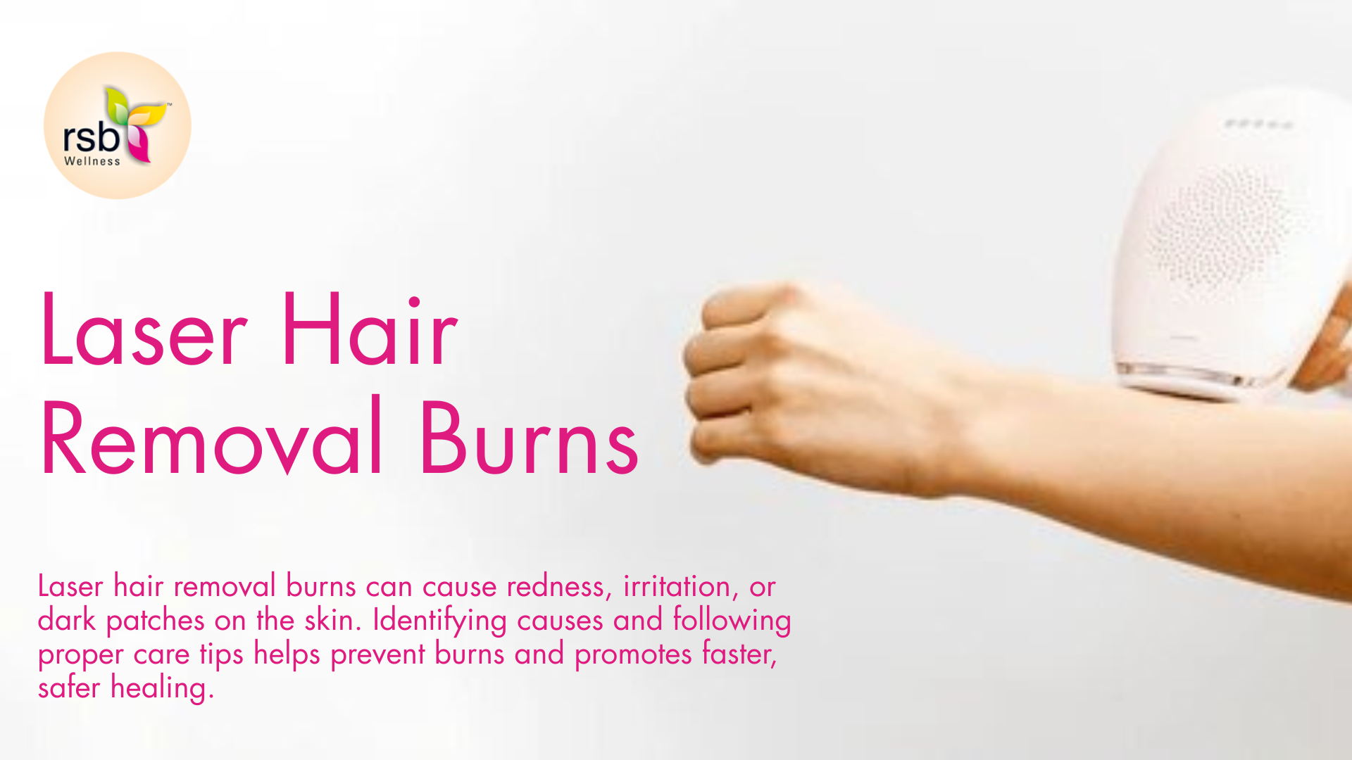 laser hair removal burns