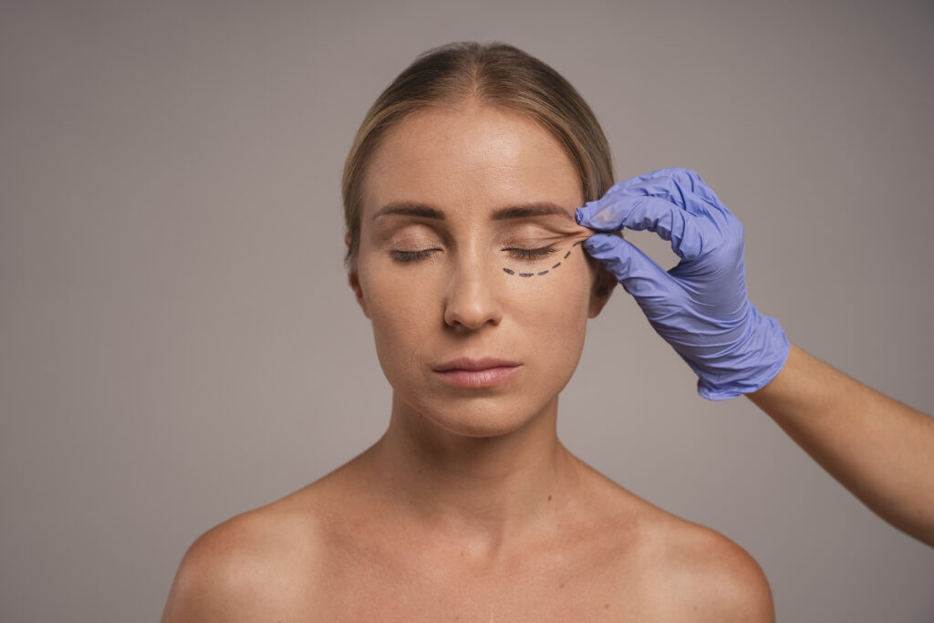 Eye filler, Under Eye Fillers