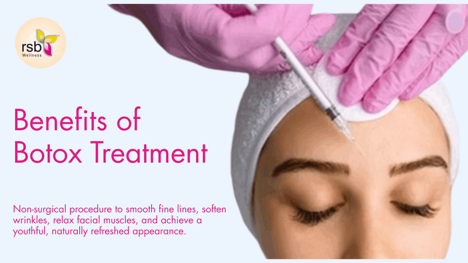 Benefits of Botox treatment
