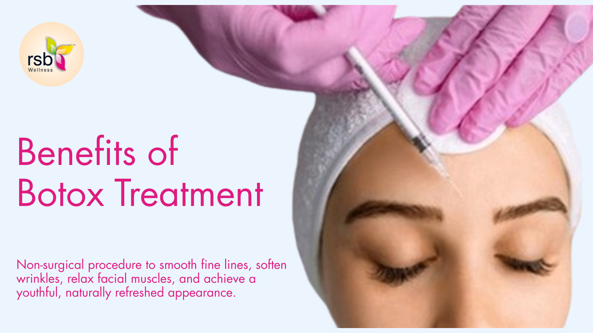 Benefits of Botox treatment
