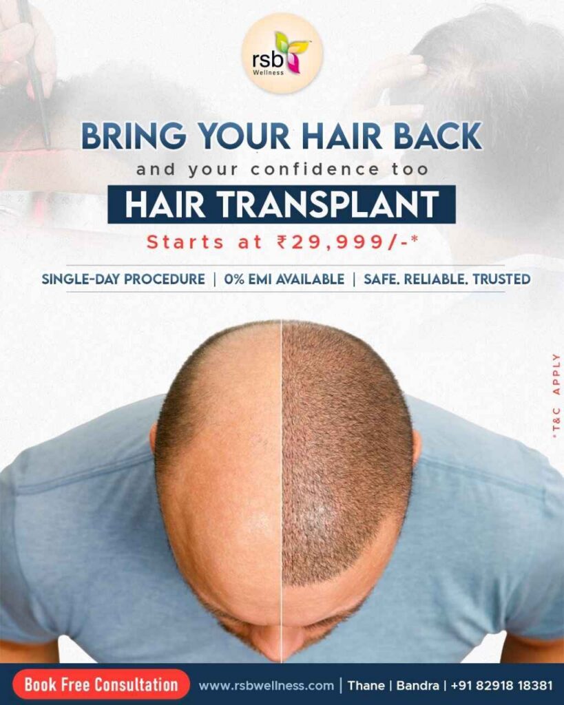 types of Hair Transplant