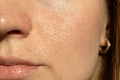 Open Pores, how to close open pores on face?