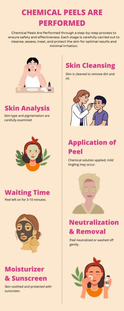 Chemical Peels Are Performed,  Chemical Peel Treatment For Hyperpigmentation