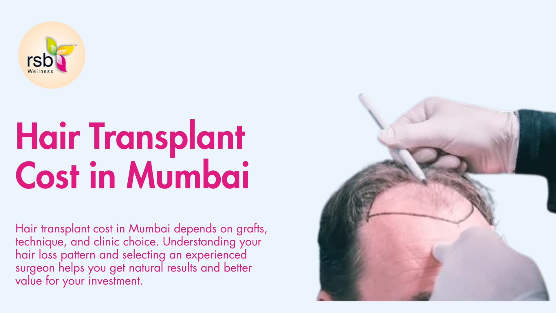 Hair Transplant Cost in Mumbai